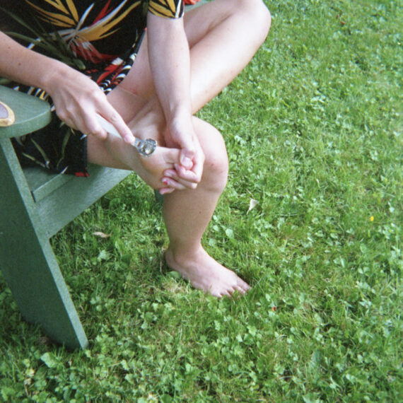 A pale-skinned person wearing a black shirt with a red and yellow pattern of leaves. They are sitting on a wooden green chair on a grassy surface. They are peeling the skin from the bottom of their foot with a silver tool.